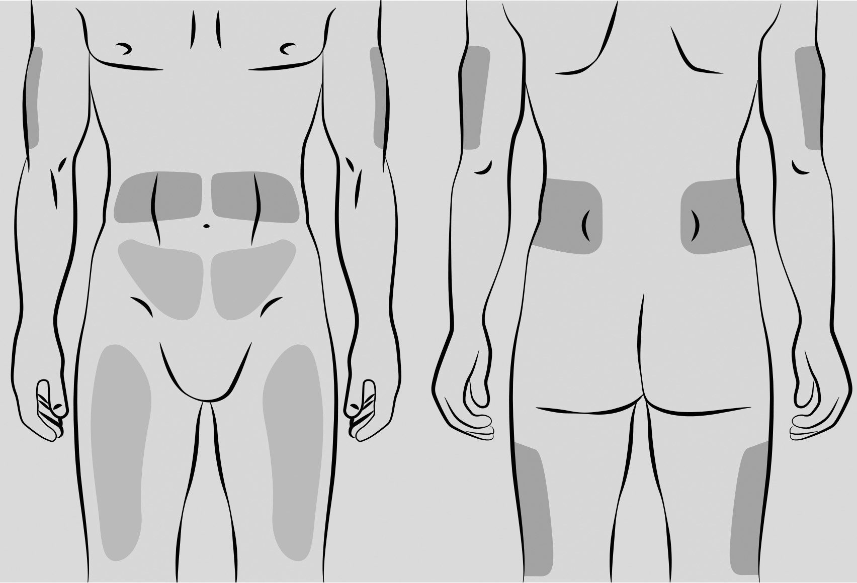Diagram showing where to insert cutaquig